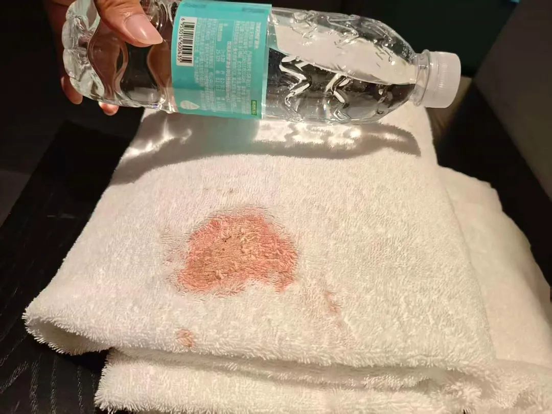 亿融策略 男子发现酒店浴巾有大片血迹，担心染病要求赔偿！酒店回应，网友热议